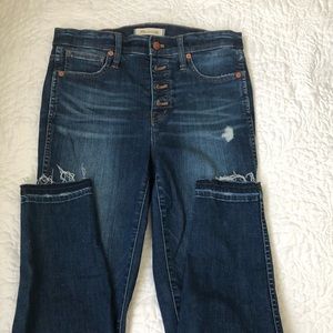 Madewell 10 in high rise button fly skinny jean